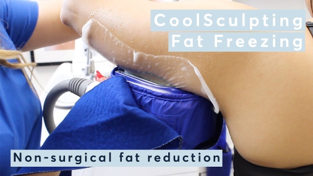 Frosty Transformation: Unveiling the Secrets of Cool Sculpting and Fat Freezing