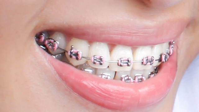 The Art of Perfect Smiles: Unveiling the Secrets of Orthodontists and Private Dentists